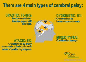 There are four types of CP.